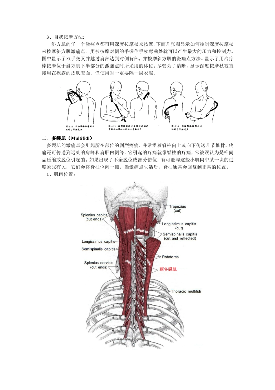 激痛点和肌肉疼痛自我按摩治疗(18)颈后痛_第3页