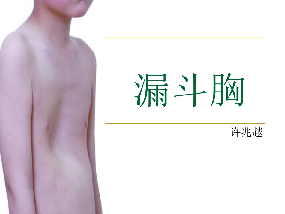 漏斗胸-ppt_第1页