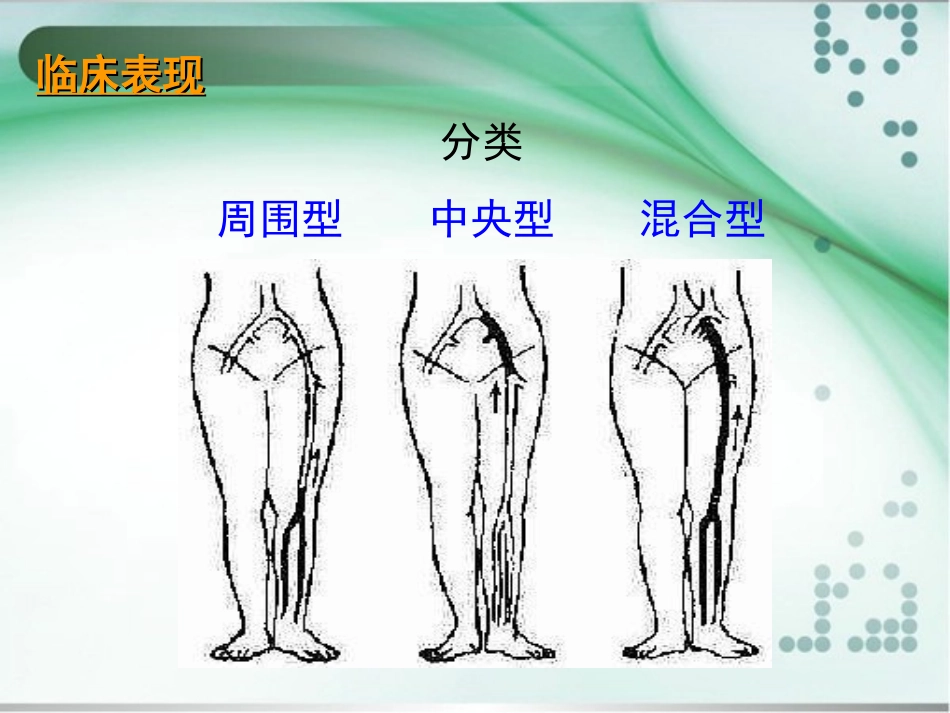 深静脉血栓形成诊治_第3页