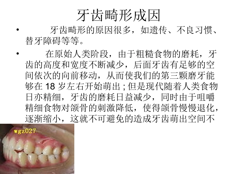 深圳矫正牙齿-口腔医院PPT_第2页