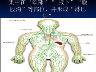 淋巴风暴 ding