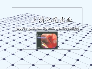 消化道出血(讲课用)