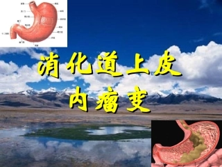 消化道上皮内瘤变