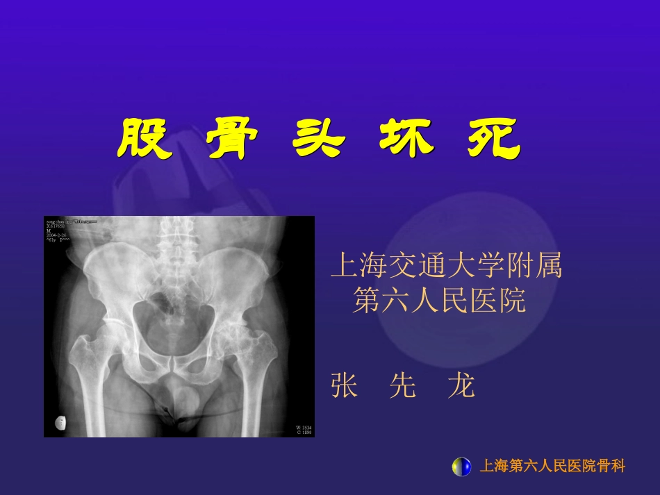 浅谈股骨头坏死_第1页