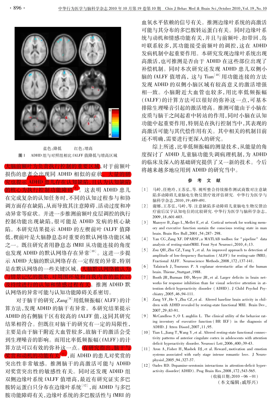 注意缺陷多动障碍儿童静息态功能磁共振_第3页