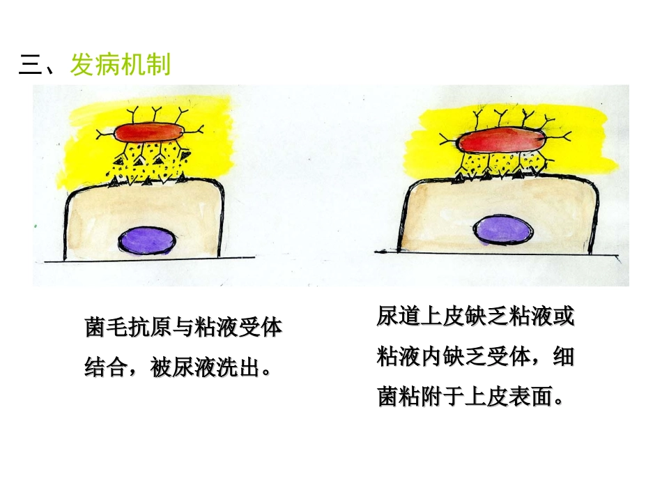 泌尿、男性生殖系统感染_第3页