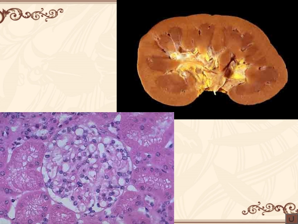 泌尿与生殖系统_第3页