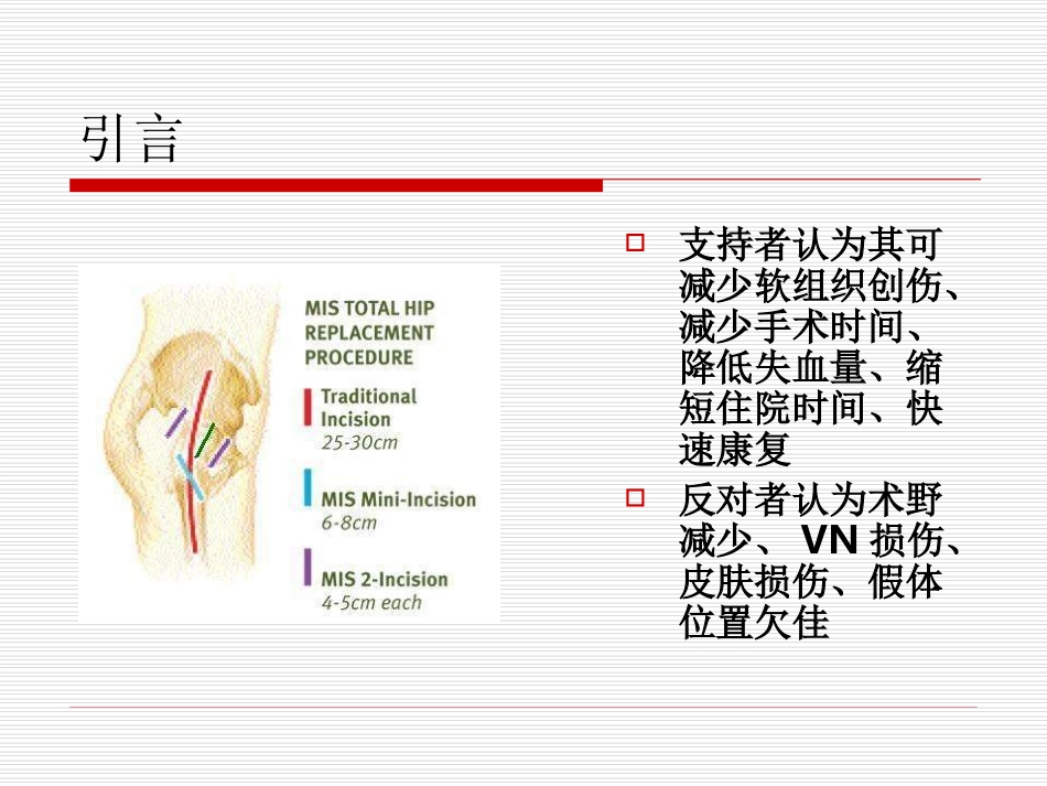 沿股骨颈后外侧小切口全髋关节置换术疗效分析_第2页