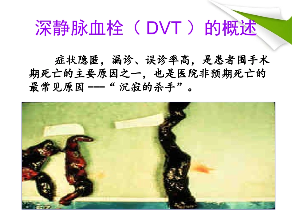 沉寂的杀手深静脉血栓_第3页