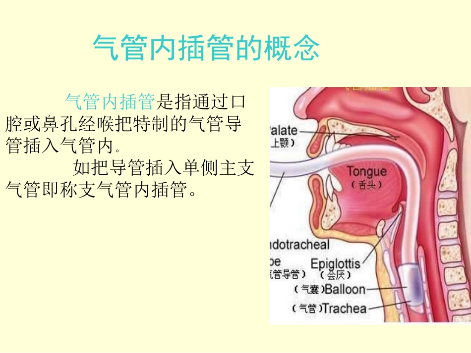 气管插管与肺隔离术_第2页