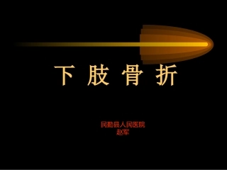 民勤县医院下肢骨折系列