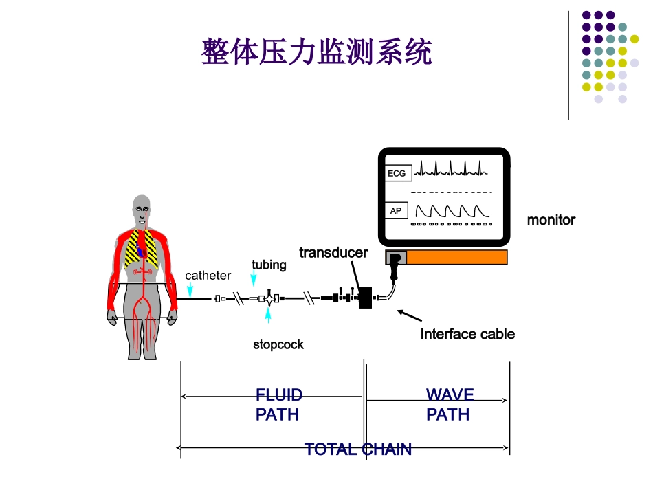有创动脉压力监测_第3页