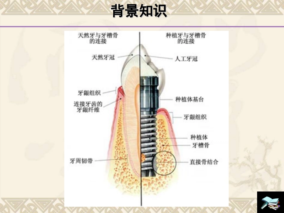 最新：牙种植体颈部骨吸收和平台转换技术研究进展-文档资料_第3页