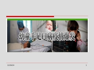 最新手足口病神经系表现山西医科大学第二医院儿科-PPT文档