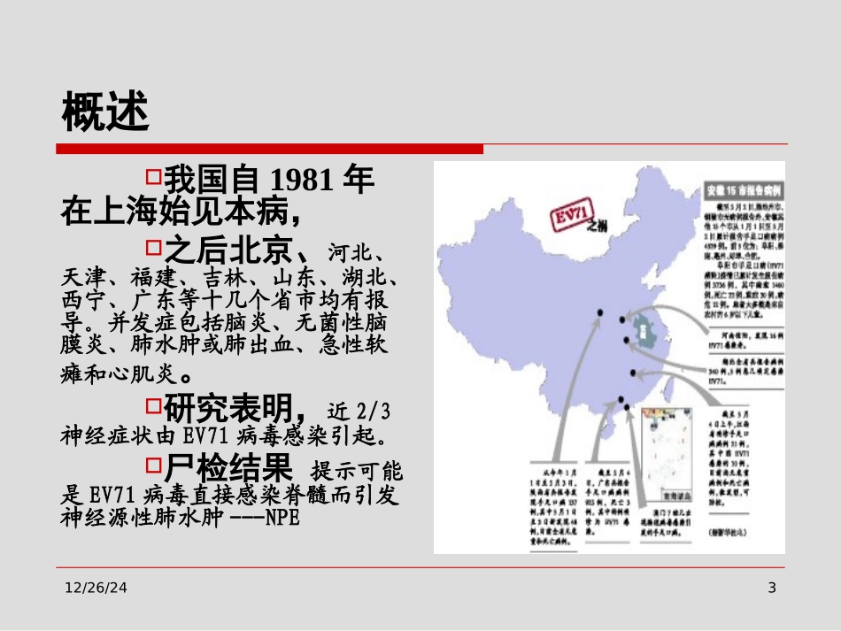 最新手足口病神经系统表现-山西医科大学第二医院儿科-PPT文档_第3页