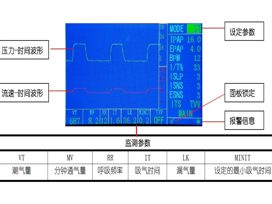 无创呼吸机Flexo应用_第2页