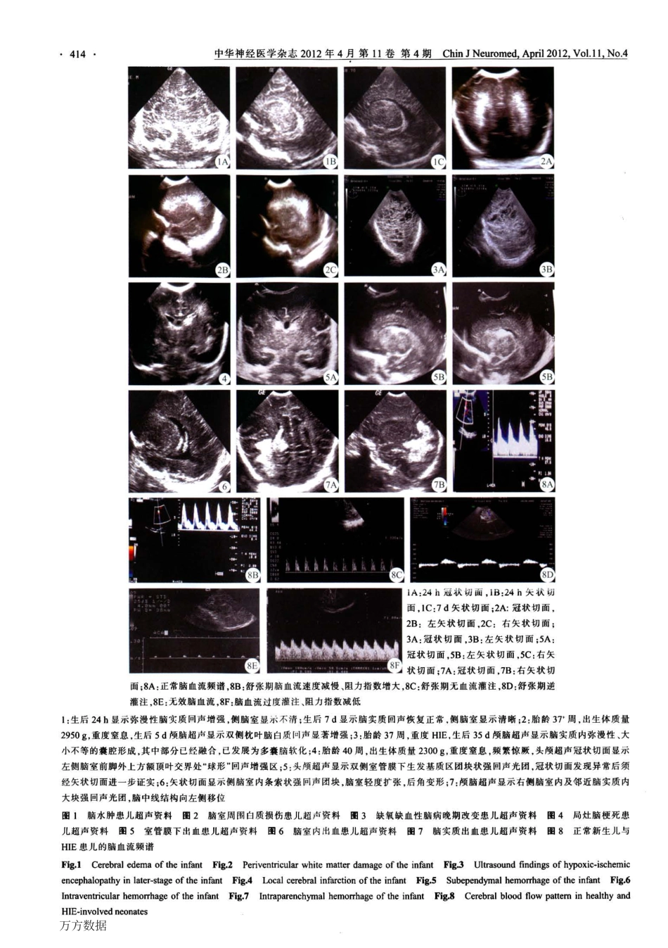 新生儿缺氧缺血性脑病超声诊断建议_第2页