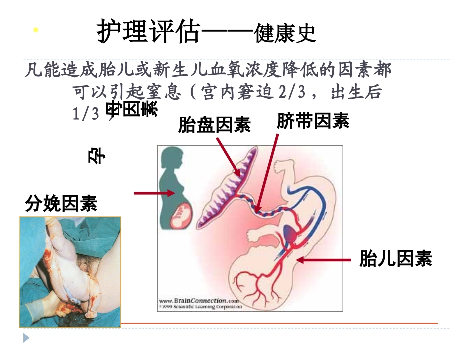 新生儿窒息-、颅脑损伤_第3页