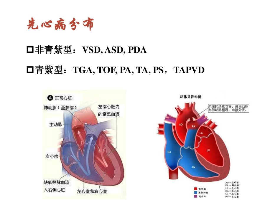 新生儿期先天性心脏病的诊断和治疗_第3页