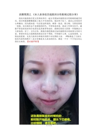 教你如何去除闭合性粉刺