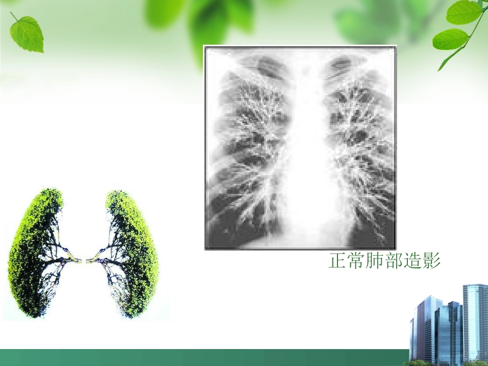 支气管扩张OK_第3页