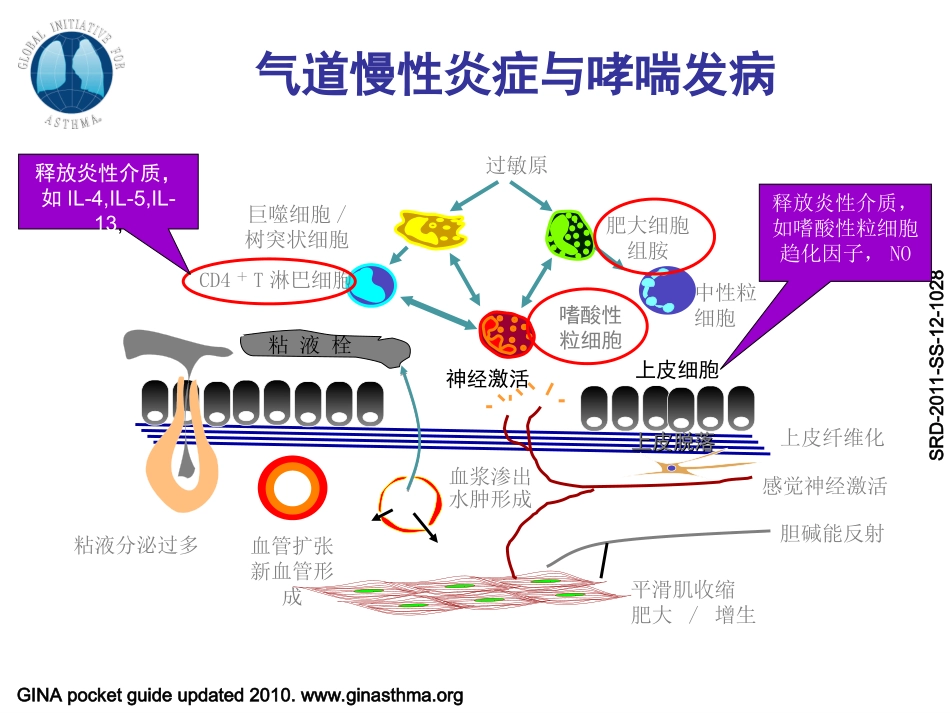 支气管哮喘指南解读_第2页