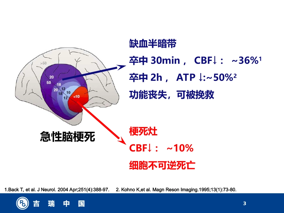 挽救缺血半暗带_第3页