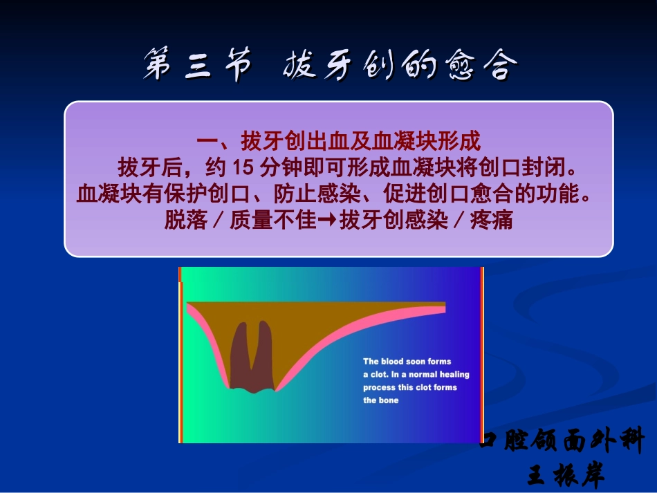 拔牙创出血及血凝块形成拔牙后-山东大学_第3页