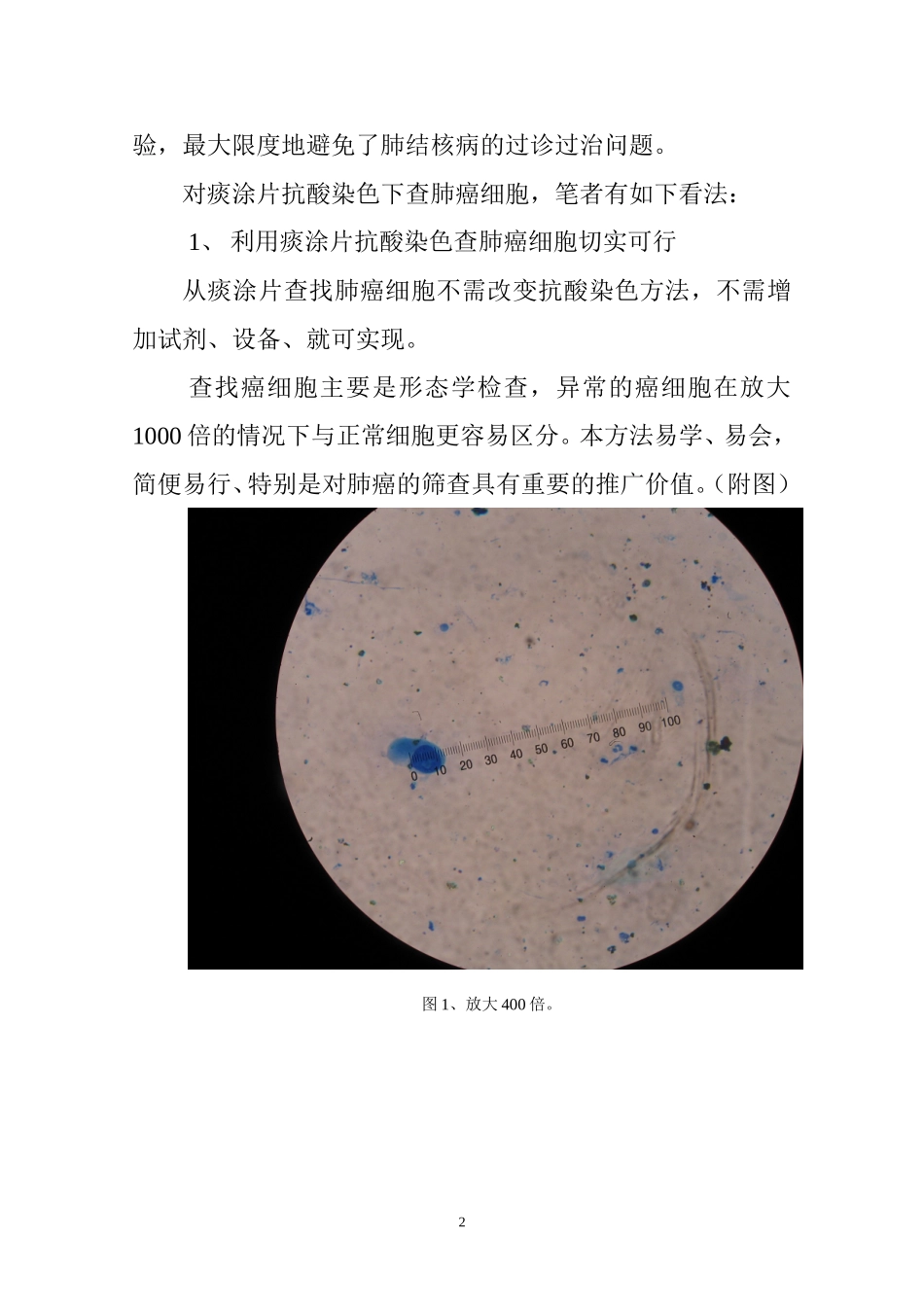 抗酸染色查肺癌做法和体会_第2页