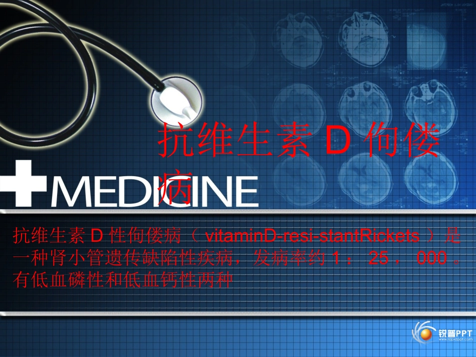 抗维生素D佝偻病_第1页