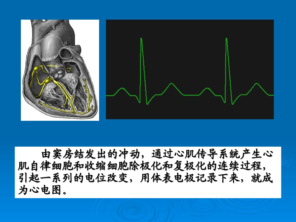 抗精神病药所致QTc间期延长、TdP和猝死_第3页