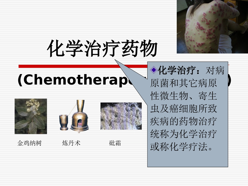 抗生素化疗药1磺胺药_第1页