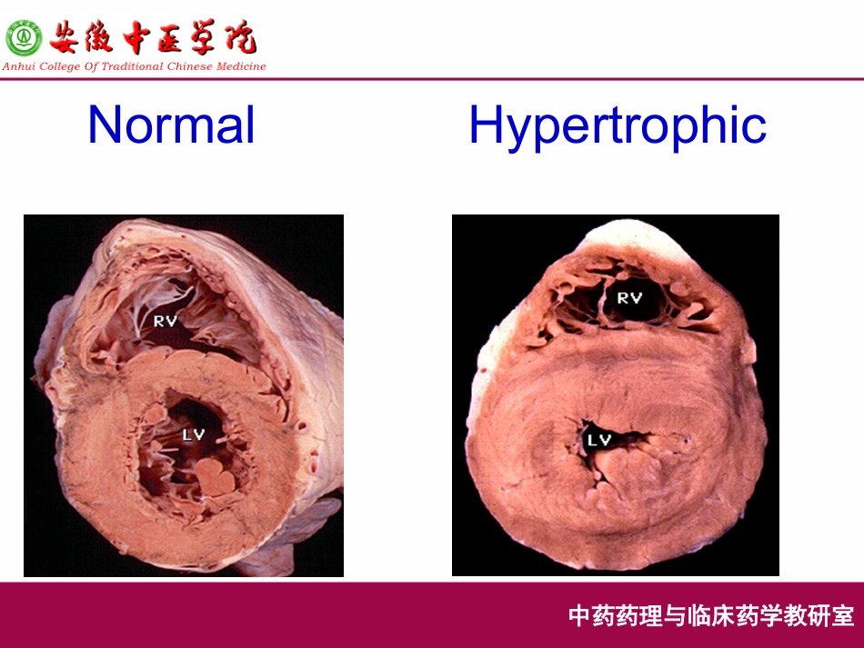 抗慢性心功能不全药-(抗心力衰竭药)_第3页