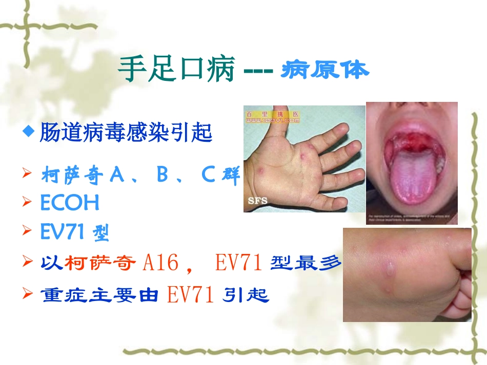 手足口病重症诊治中的相关问题(钱素云)_第2页