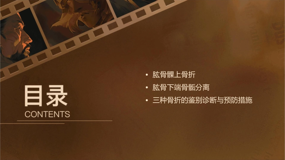 肱骨干骨折肱骨髁上骨折和肱骨下端骨骺分离课件_第2页