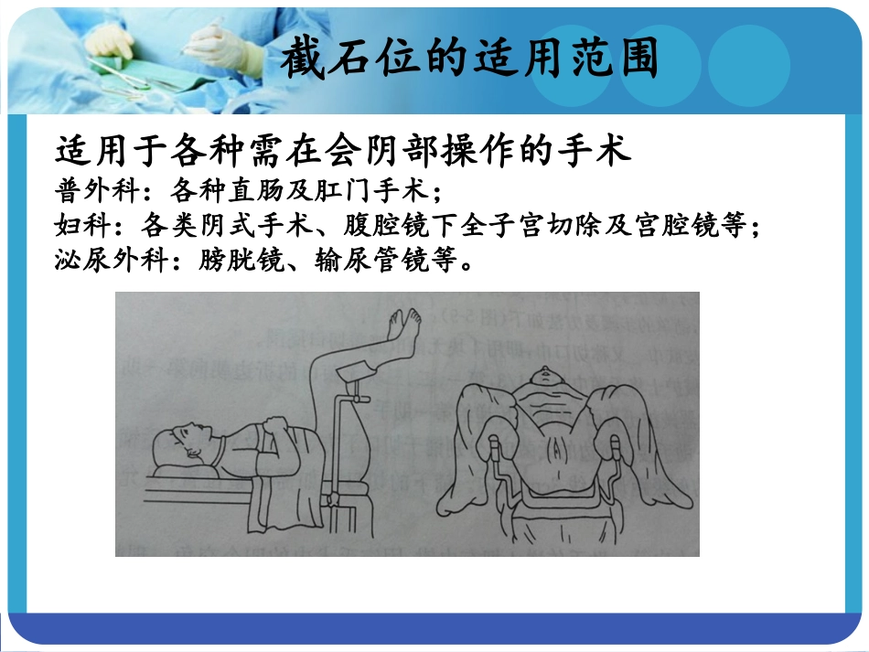 手术室截石位体位注意事项_第3页