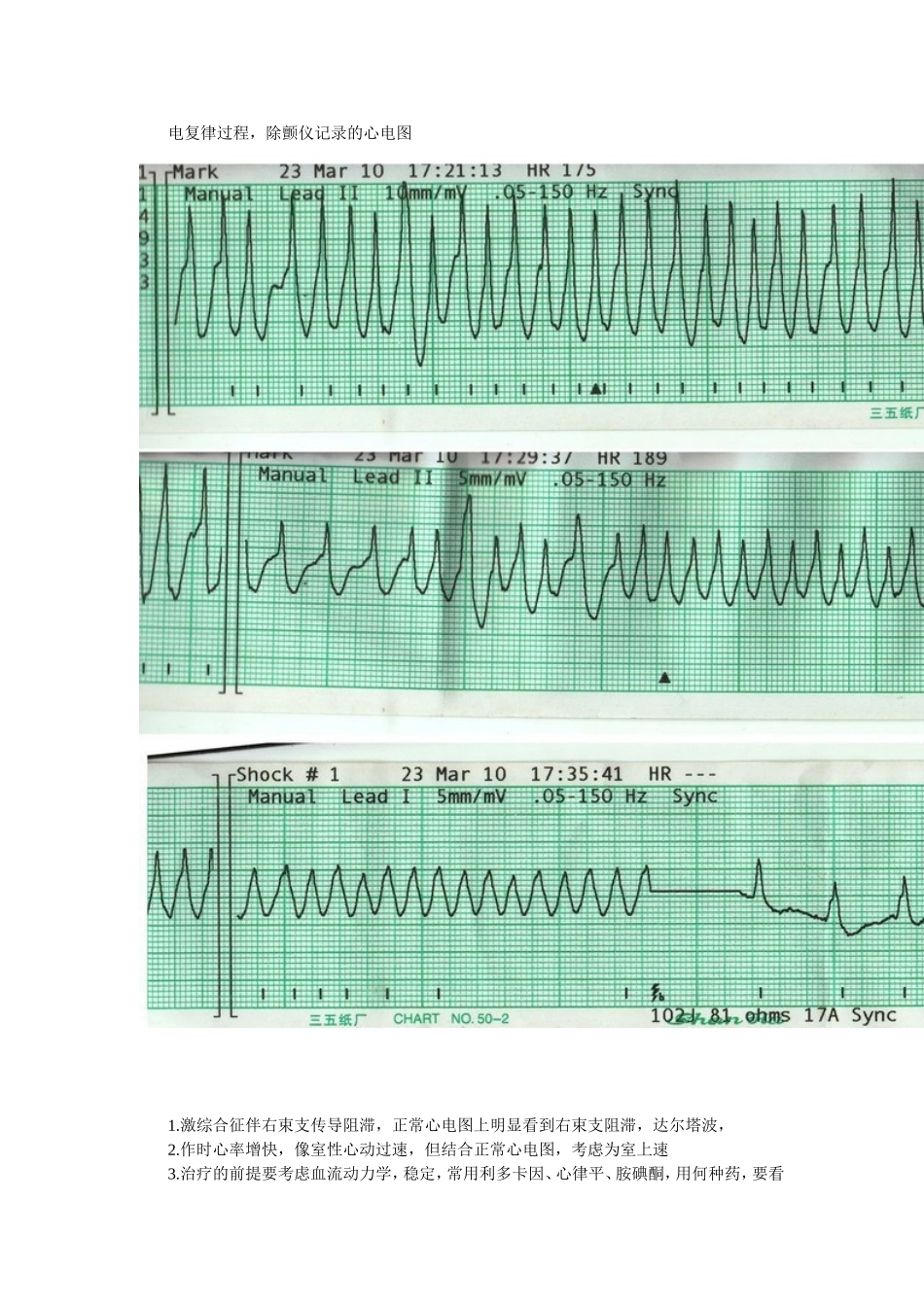 房颤,室颤,室上速？_第3页