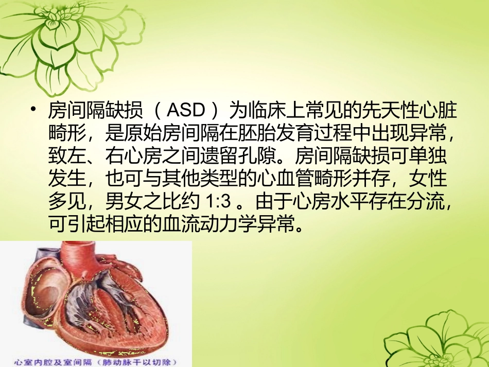 房间隔缺损护理查房_第2页
