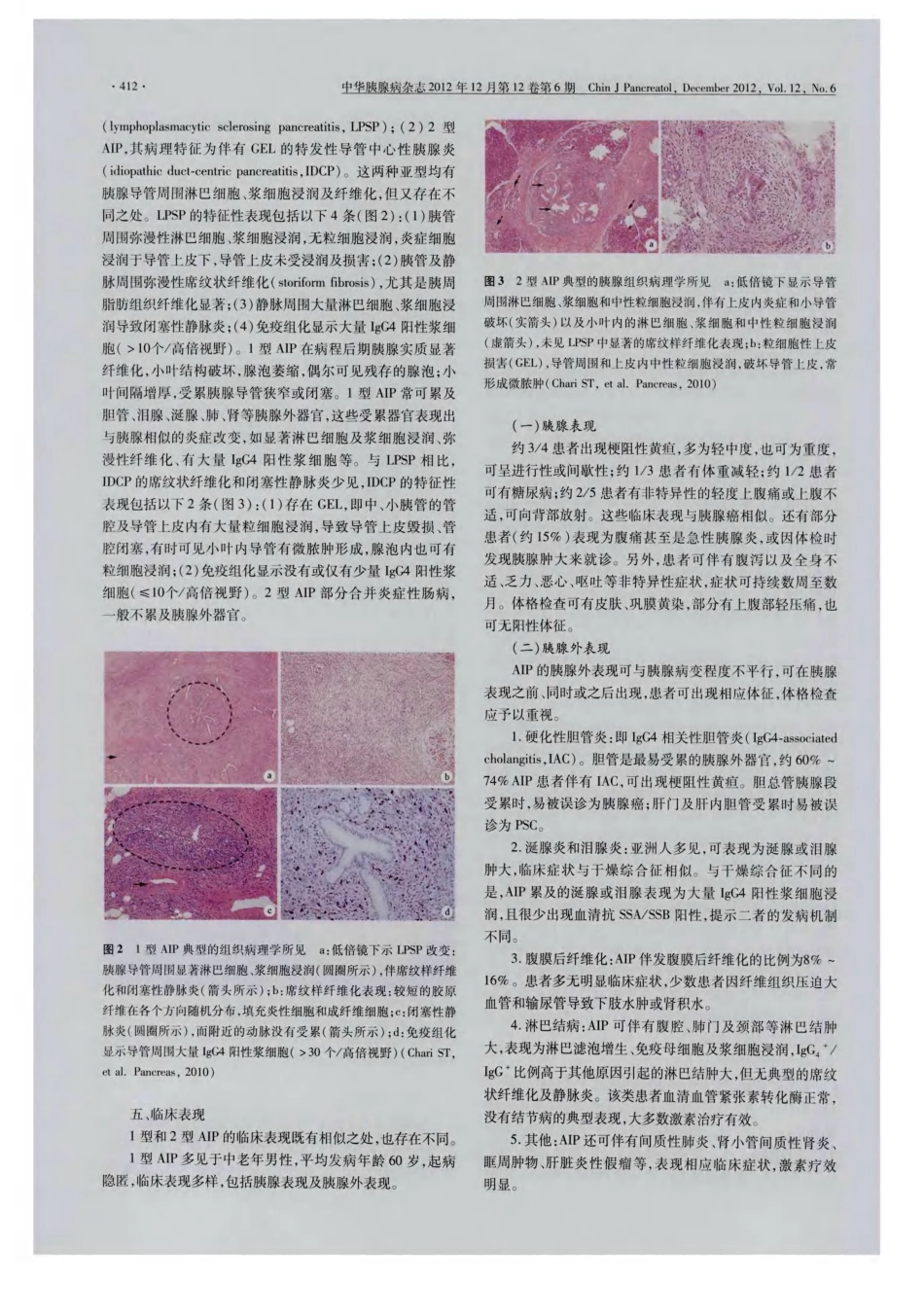 我国自身免疫性胰腺炎共识意见(草案2012,上海)_第3页