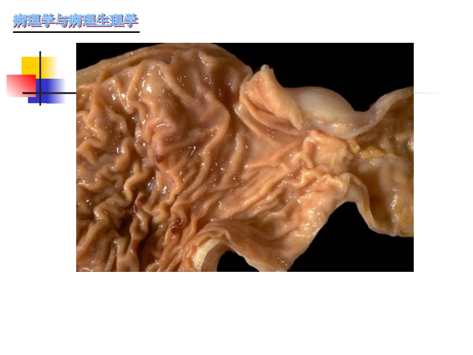 慢性胃炎-(2)_第2页