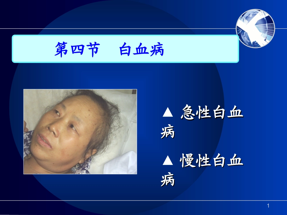 慢性淋巴细胞白血病_第1页