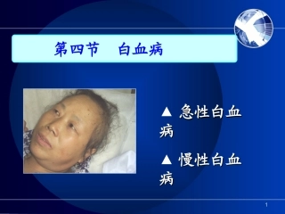 慢性淋巴细胞白血病