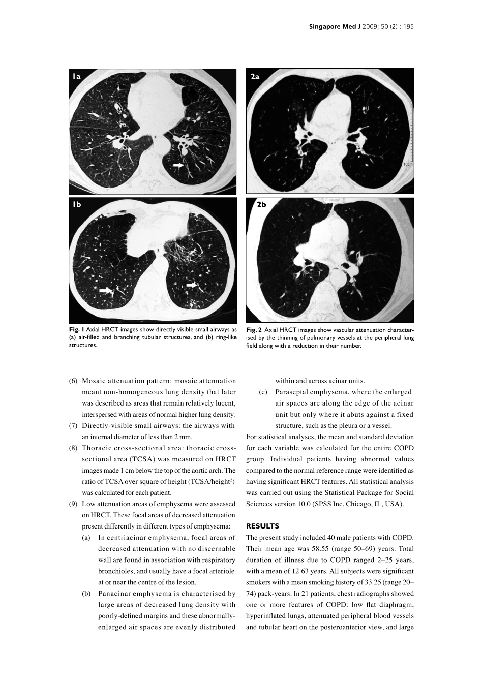 慢性梗阻性肺病CT表现_第3页