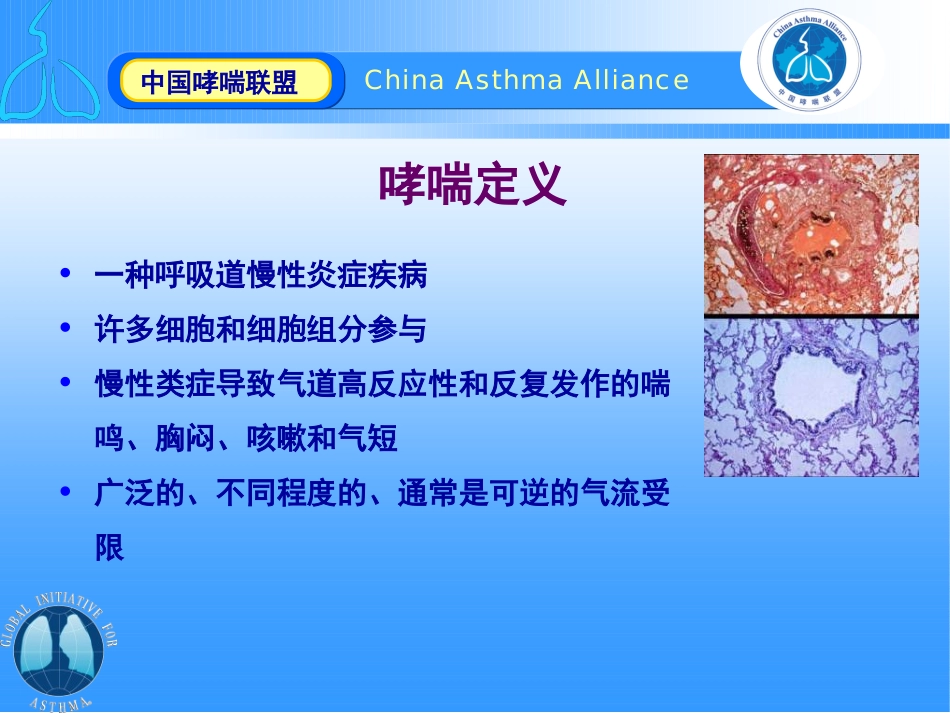 慢性哮喘的药物联合治疗_第2页