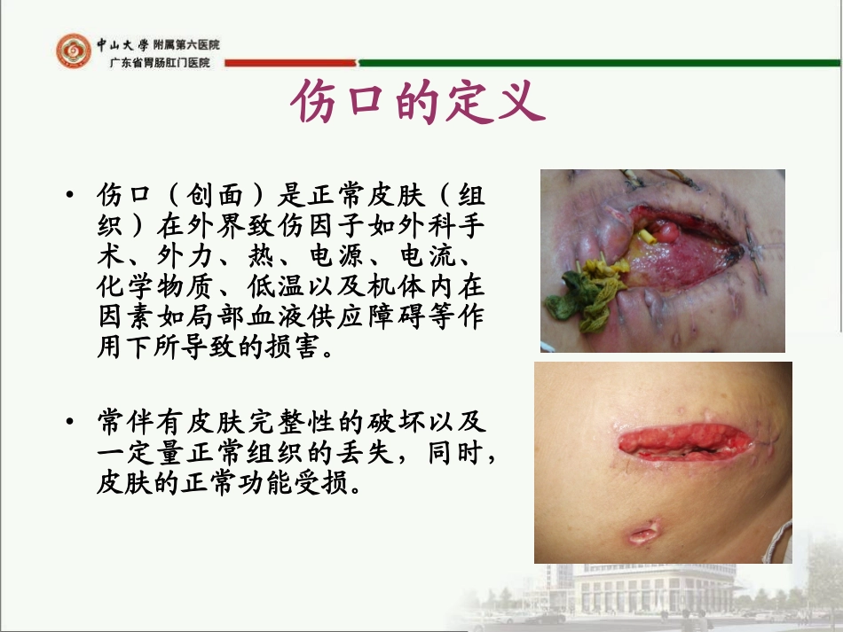 感染创面的处理及个案分析.ppt_第2页