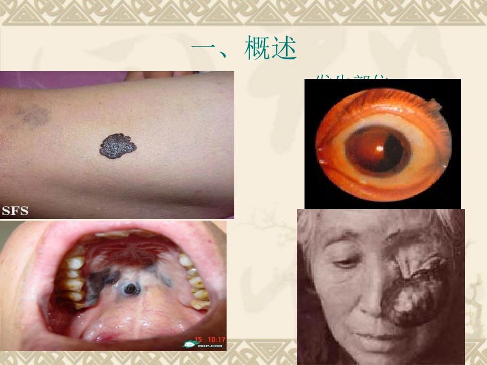 恶黑.放疗科_第3页