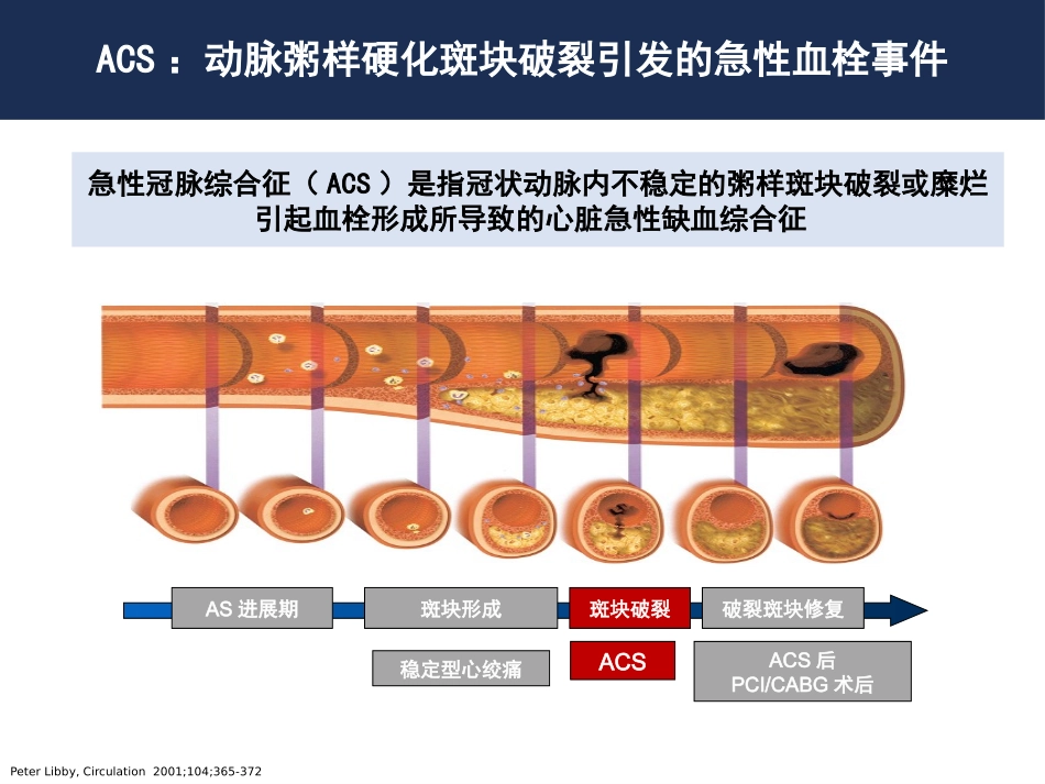 急诊指南解读20160405_第2页