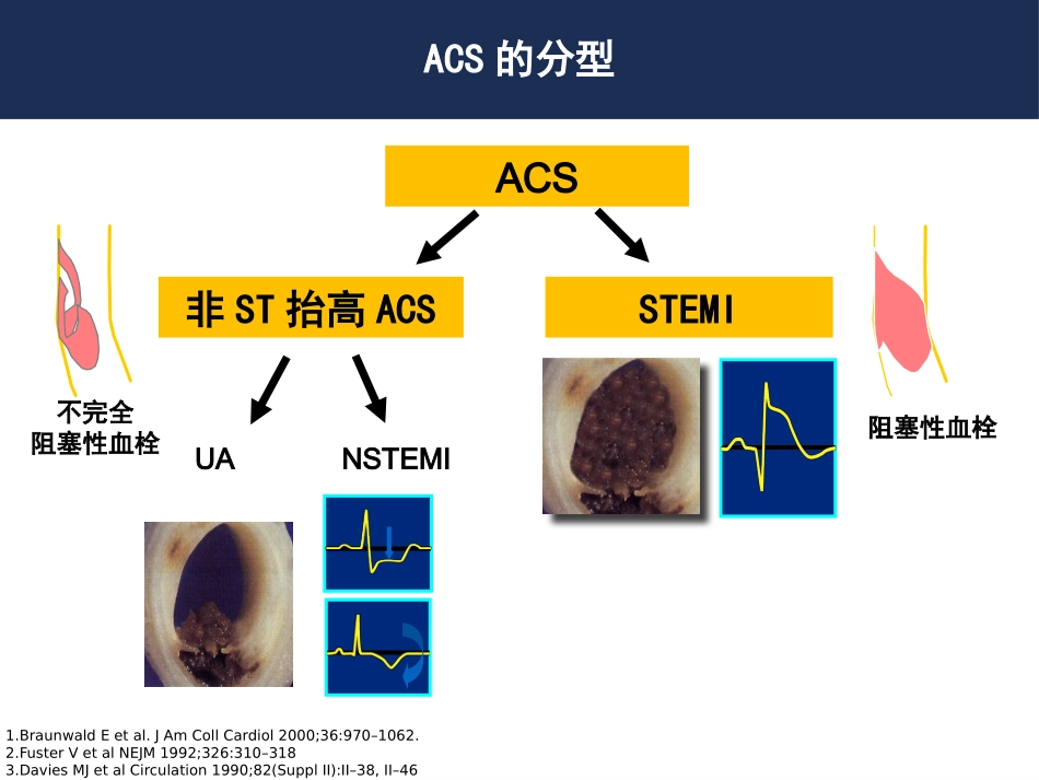 急诊指南解读20160405_第3页