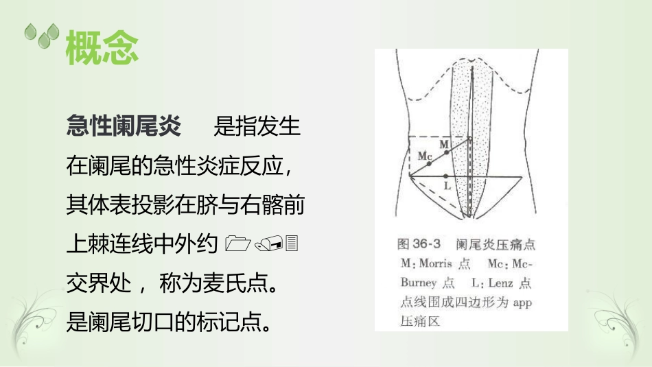 急性阑尾炎(1)_第3页