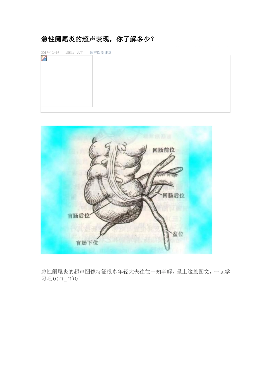 急性阑尾炎的超声表现_第1页